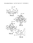 Device and Method for Temporary or Permanent Suspension of an Implantable     Scaffolding Containing an Orifice for Placement of a Prosthetic or     Bio-Prosthetic Valve diagram and image