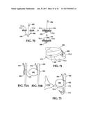 Device and Method for Temporary or Permanent Suspension of an Implantable     Scaffolding Containing an Orifice for Placement of a Prosthetic or     Bio-Prosthetic Valve diagram and image