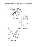 Device and Method for Temporary or Permanent Suspension of an Implantable     Scaffolding Containing an Orifice for Placement of a Prosthetic or     Bio-Prosthetic Valve diagram and image