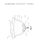 THROMBUS MANAGEMENT AND STRUCTURAL COMPLIANCE FEATURES FOR PROSTHETIC     HEART VALVES diagram and image