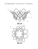 THROMBUS MANAGEMENT AND STRUCTURAL COMPLIANCE FEATURES FOR PROSTHETIC     HEART VALVES diagram and image