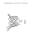 THROMBUS MANAGEMENT AND STRUCTURAL COMPLIANCE FEATURES FOR PROSTHETIC     HEART VALVES diagram and image