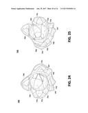 THROMBUS MANAGEMENT AND STRUCTURAL COMPLIANCE FEATURES FOR PROSTHETIC     HEART VALVES diagram and image