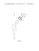 ACETABULAR CUP STRUCTURE diagram and image