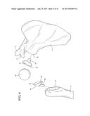 MULTI-COMPONENT IMPLANT ASSEMBLY WITH DUAL ARTICULATING AND/OR ROTATING     SURFACES diagram and image