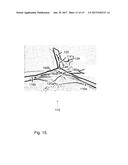 BAG WELD WITH GUSSET diagram and image