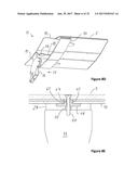 SORTING SYSTEM HAVING COVER PLATES CLOSING GAPS BETWEEN SUPPORT STRUCTURES diagram and image