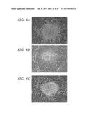 METHODS USING REPROGRAMMED CELLS FOR REGENERATIVE, RESTORATIVE, AND     REJUVENATIVE THERAPIES diagram and image