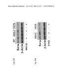 PHARMACEUTICAL COMPOSITIONS COMPRISING RNA AND USE FOR TREATING CANCER diagram and image