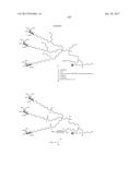 COMPOSITIONS AND METHODS FOR MODULATING PKK EXPRESSION diagram and image