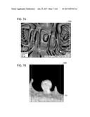 MEDICAL IMAGE PROCESSING APPARATUS diagram and image