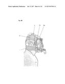 FIXING TOOL FOR ATTACHING ARTIFICIAL VENTILATOR diagram and image