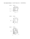 FIXING TOOL FOR ATTACHING ARTIFICIAL VENTILATOR diagram and image