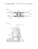 FIXING TOOL FOR ATTACHING ARTIFICIAL VENTILATOR diagram and image