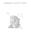 FIXING TOOL FOR ATTACHING ARTIFICIAL VENTILATOR diagram and image