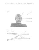 FIXING TOOL FOR ATTACHING ARTIFICIAL VENTILATOR diagram and image