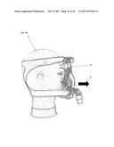 FIXING TOOL FOR ATTACHING ARTIFICIAL VENTILATOR diagram and image