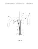 ASYMMETRIC CATHETER CURVE SHAPES diagram and image