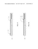 Medical Device Insertion Apparatus, System and Method diagram and image