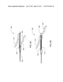 Medical Device Insertion Apparatus, System and Method diagram and image