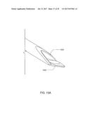 Medical Device Insertion Apparatus, System and Method diagram and image