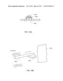 Medical Device Insertion Apparatus, System and Method diagram and image