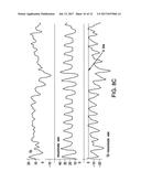 DEVICES AND METHODS FOR ALLEVIATING LYMPHATIC SYSTEM CONGESTION diagram and image