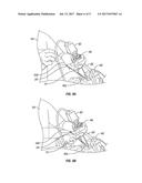 SYSTEMS AND METHODS FOR TRANSNASAL DILATION OF PASSAGEWAYS IN THE EAR,     NOSE OR THROAT diagram and image