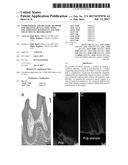 COMPOSITIONS AND DELIVERY METHODS FOR TREATING DENTAL INFECTIONS,     INFLAMMATION, SENSITIVITY, AND FOR USE IN DENTAL RESTORATIONS diagram and image