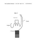 COMPOSITIONS AND DELIVERY METHODS FOR TREATING DENTAL INFECTIONS,     INFLAMMATION, SENSITIVITY, AND FOR USE IN DENTAL RESTORATIONS diagram and image