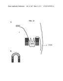 COMPOSITIONS AND DELIVERY METHODS FOR TREATING DENTAL INFECTIONS,     INFLAMMATION, SENSITIVITY, AND FOR USE IN DENTAL RESTORATIONS diagram and image