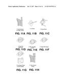 SYSTEMS AND METHODS FOR ESTABLISHING A NERVE BLOCK diagram and image