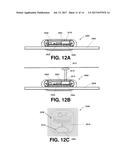 SYSTEMS AND METHODS FOR ESTABLISHING A NERVE BLOCK diagram and image