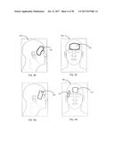 APPARATUSES AND METHODS FOR TRANSDERMAL ELECTRICAL STIMULATION OF NERVES     TO MODIFY OR INDUCE A COGNITIVE STATE diagram and image