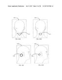 APPARATUSES AND METHODS FOR TRANSDERMAL ELECTRICAL STIMULATION OF NERVES     TO MODIFY OR INDUCE A COGNITIVE STATE diagram and image