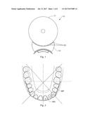 TOOTH-WHITENING DEVICE diagram and image