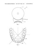 TOOTH-WHITENING PROCESS diagram and image