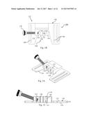 Immobilization System to Support an In Vivo Medical Device diagram and image