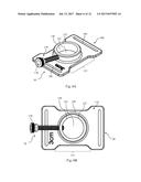 Immobilization System to Support an In Vivo Medical Device diagram and image