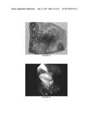 CHITOSAN SUPERFINE FIBER SYSTEMS diagram and image