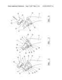 BONE CEMENT COMPOSITION diagram and image