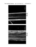 TISSUE INTEGRATING MATERIALS FOR WOUND REPAIR diagram and image