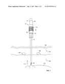 Decompression Needle Assembly diagram and image