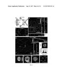 SYSTEMS, METHODS, AND COMPUTER-READABLE MEDIA FOR ULTRA-HIGH RESOLUTION 3D     IMAGING OF WHOLE CELLS diagram and image