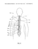 Skeletal Manipulation Method diagram and image