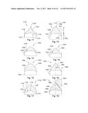 Downhole Drill Bit Incorporating Cutting Elements of Different Geometries diagram and image