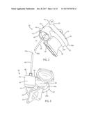 TURBOCHARGER TURBINE STAGE VALVES CONTROLLED BY A SINGLE ACTUATOR diagram and image