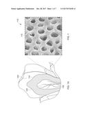 APPARATUS AND METHOD FOR ASSESSING TOOTH-SENSITIVITY TREATMENT BY     ORAL-CARE PRODUCT diagram and image