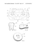 APPARATUS AND METHOD FOR ASSESSING TOOTH-SENSITIVITY TREATMENT BY     ORAL-CARE PRODUCT diagram and image