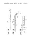 ENDOVASCULAR DEVICES AND METHODS FOR EXPLOITING INTRAMURAL SPACE diagram and image